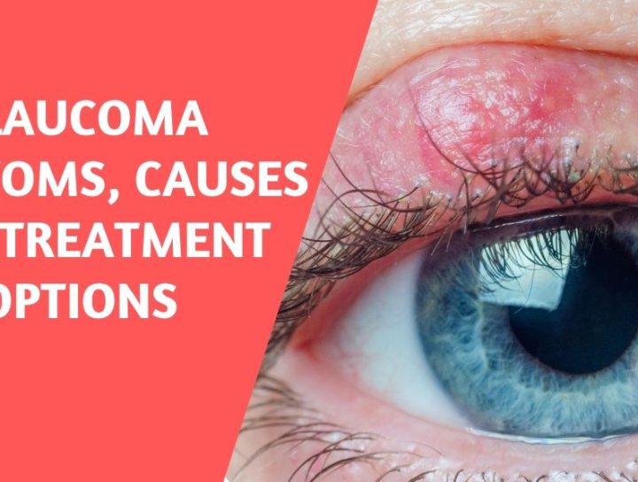 Glaucoma - Symptoms and Causes