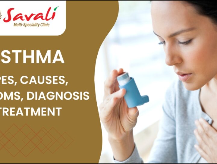 Asthma symptoms and causes