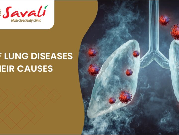 Types of Lung Diseases